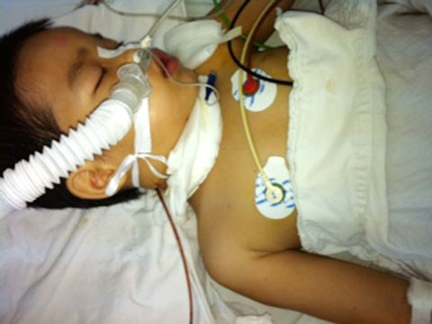 Đau xót bé trai nghi bị cha cứa cổ