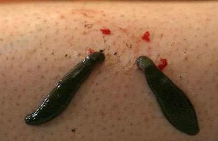 Đỉa là một nhóm sinh vật thủy sinh thuộc ngành giun đốt (Annelida), có thân mềm, thích tấn công cá và động vật bò sát. Nếu gặp người, chúng cũng không ngán. Con người, trâu bò... khi lội dưới nước, gặp đỉa là chúng bám lấy ngay để hút máu. 
