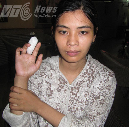 cắn đứt ngón tay, An Dương, Hải Phòng, em chồng