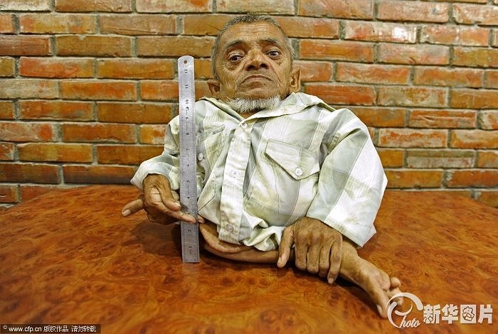 Ông Master Nau, 73 tuổi, sống tại Nepal, đang rất hi vọng trở thành người đàn ông lùn nhất thế giới do Tổ chức Guiness công nhận.