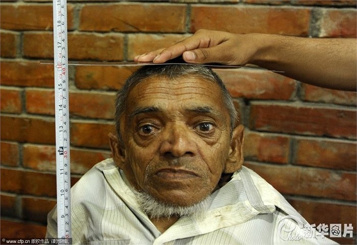 Được biết, chiều cao của ông đo gần đây nhất là 16 inch, tương đương 40 cm, chỉ cao hơn một xíu so với chiếc máy ảnh có gắn ống zoom.