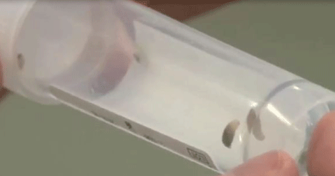 Giòi sống được gắp ra bên ngoài