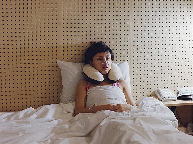 Thiếu nữ nằm vật vờ sau phẫu thuật thẩm mỹ