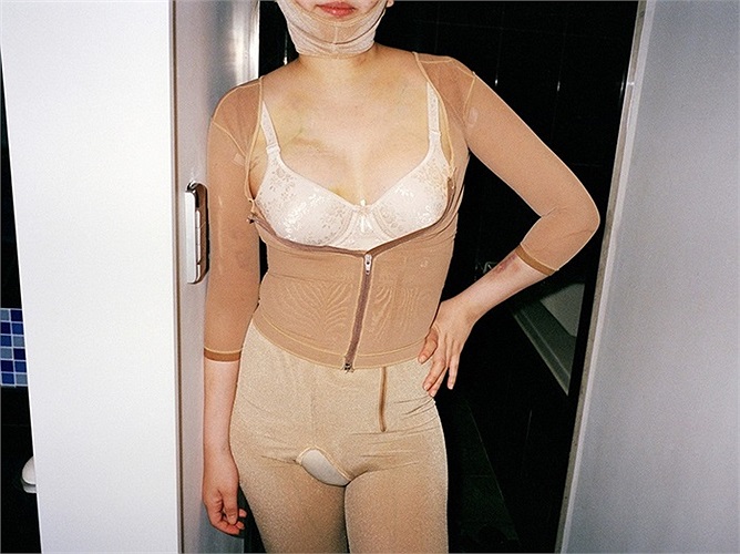 Bất chấp nối đau thể xác để đẹp hơn