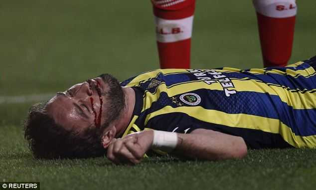 Gonul chấn thương