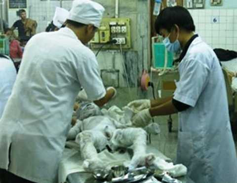 Bình Phước, nổ gas, Chợ Rẫy, tử vong, 3 mẹ con, bệnh viện