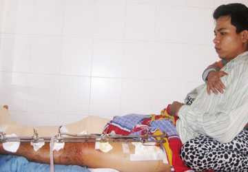 Nạn nhân bị công an bắn 7 phát vào chân