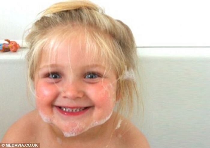 Bé Jessica Leng, 4 tuổi, ngụ tại hạt Yorkshire - Anh, gần đây đã trở nên xinh đẹp và dễ thương hơn sau khi chữa trị thành công một cục bướu to trên mặt. 