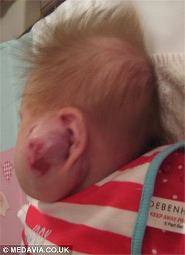 Được biết, khi Jessica chào đời, bố mẹ của bé đã hết sức hốt hoảng sau khi phát hiện một cục bướu nhỏ trên mặt của con gái. Cục bướu này từ từ lớn dần theo thời gian. 