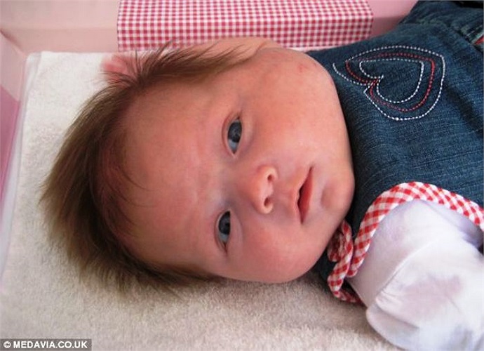 Con gái tôi thường hay quấy khóc, thỉnh thoảng cháu không thể nuốt thức ăn được và thở gấp, mẹ của em bé cho biết.