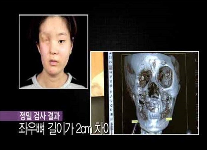 Hình chụp xương mặt của cô gái trẻ. 