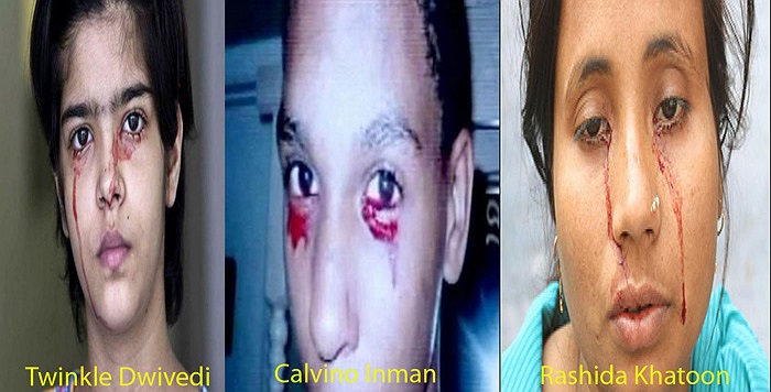 Họ đã phải kêu gọi ủng hộ, gây quỹ từ thiện nhằm tiếp tục theo đuổi điều trị. 