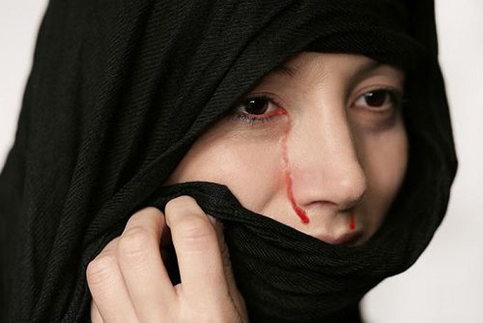 Nguyên nhân chủ yếu do xung huyết cấp, viêm kết mạc cấp, rối loạn tuyến tiết nước mắt hay do một khối u nào đó trong não. 