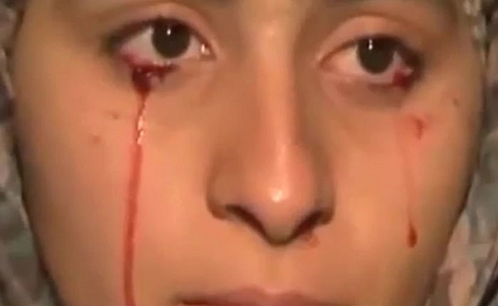 Những người sau khi mắc chứng này đều tự khỏi mà không cần chạy chữa gì.