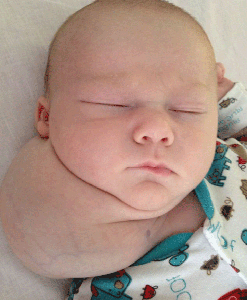 Harry nhìn như hai đầu