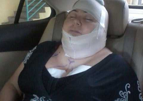 phãu thuật thẩm mỹ