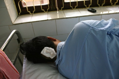 Nổ súng bắn 5 cán bộ: Lời kể người thoát khỏi họng súng