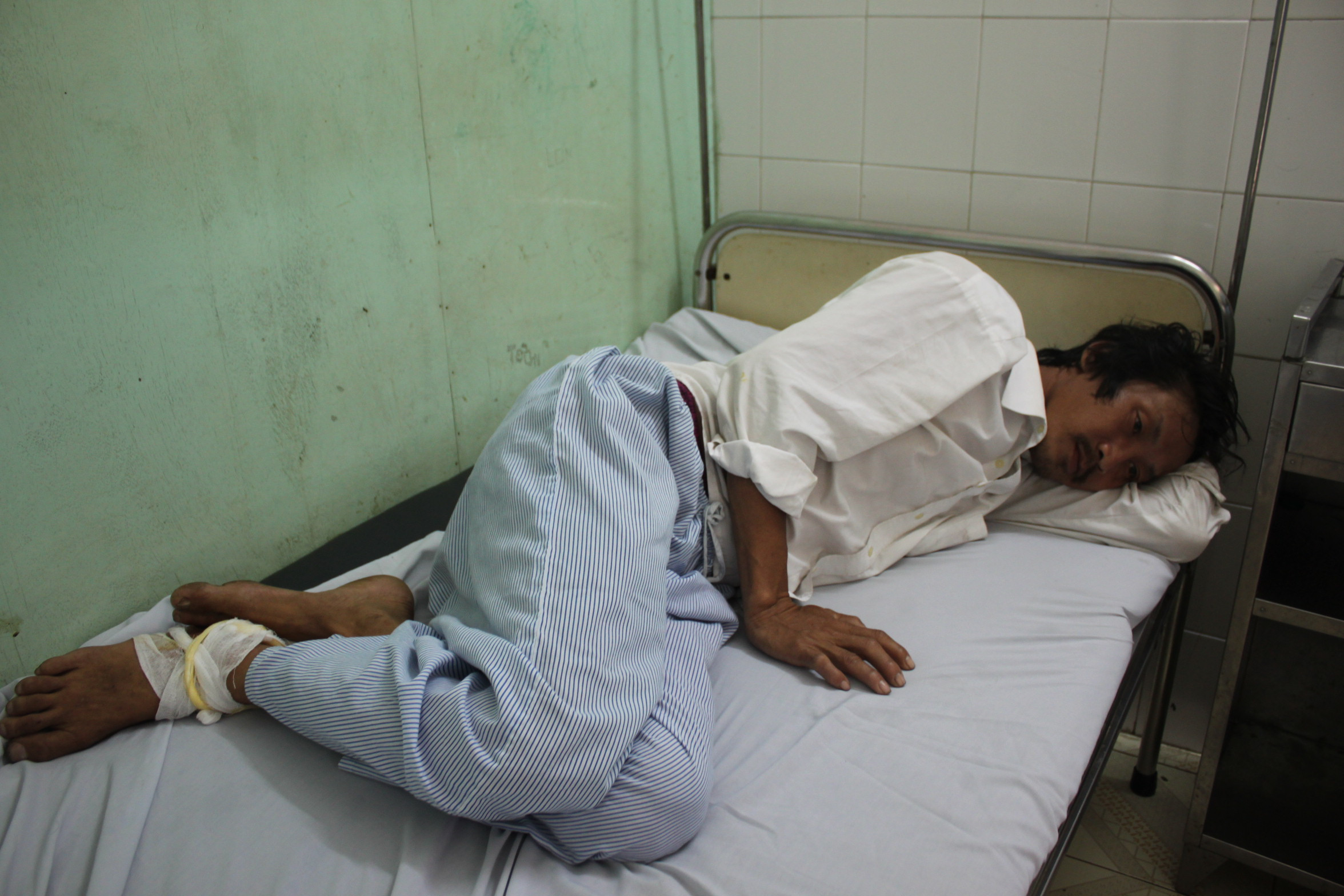 Anh Nguyễn Văn Hợp nằm trên giường bệnh