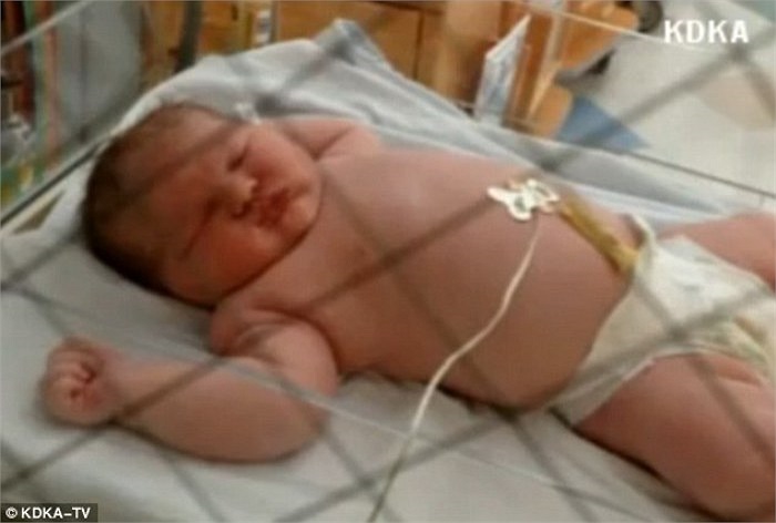 Một em bé vừa chào đời tại bệnh viện Pennsylvania của Mỹ nặng gần 14 pounds (tương đương 6,3 ký). 