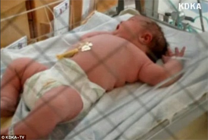 Đây là đứa bé được cho là lớn nhất từ trước đến nay tại bệnh viện này.