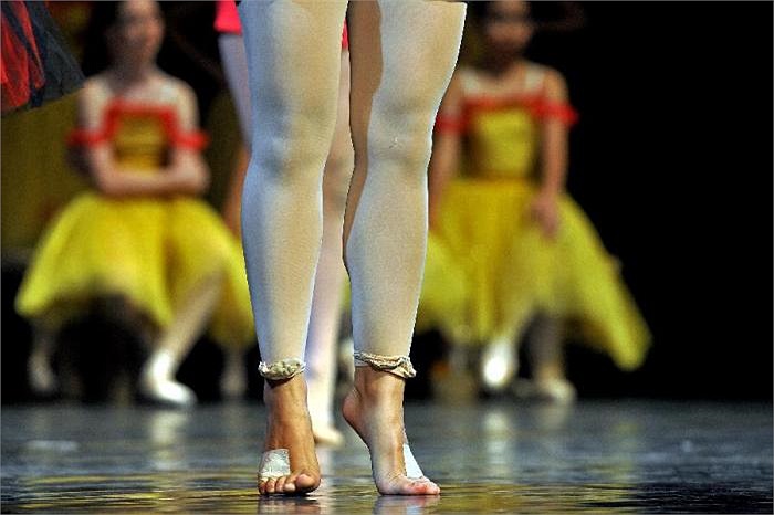 Sự thành công nào cũng đi kèm với đau thương và nước mắt, bộ môn múa ba lê cũng không ngoại lệ. Trong ảnh là một đôi chân đầy thương tích của nữ sinh trường múa.