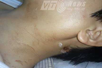 công an TP Hải Phòng, Công an huyện An Dương, Viện KSND Tối cao