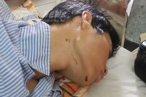 Công an xã Liên Am, Vĩnh Bảo, Hải Phòng, đánh dân