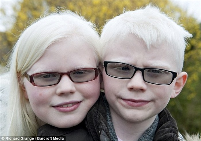 Tưởng chừng như cuộc sống sẽ rơi vào ngõ cụt, tăm tối với gia đình cô, đặc biệt là 2 em bé mắc bệnh bạch tạng. 