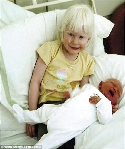 Chị gái Jessica ôm em trai Ben vào lòng.