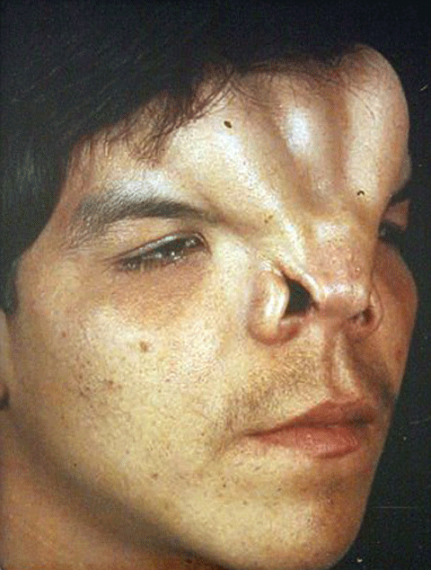 Martin trước khi phẫu thuật