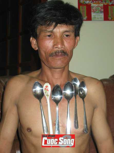 người phát ra điện