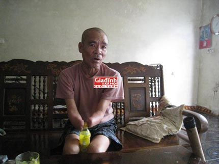 Ông Đặng Văn Lự đang cố gắng mở chai nước bằng hai cánh tay cụt của mình.