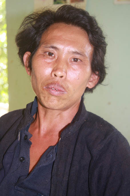 mọc đuôi