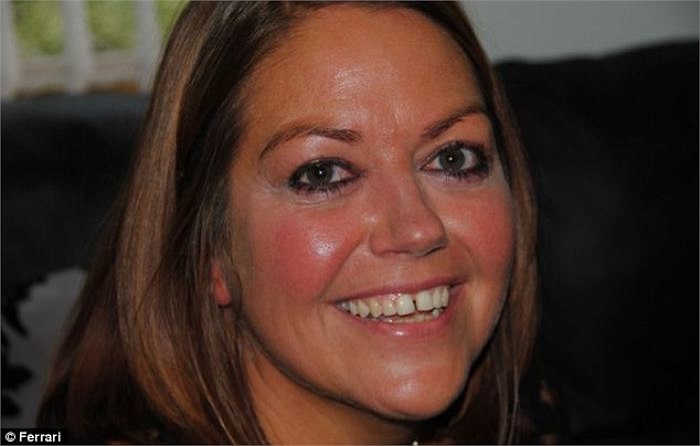 Suốt hơn 10 năm trời, chị Caroline Medcalf, 42 tuổi, ngụ tại Anh, đã phải đeo lông mi giả để cho bớt xấu xí.