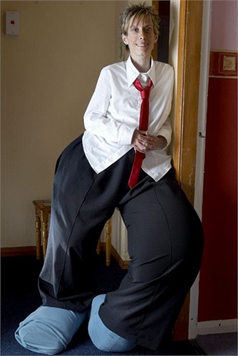 Những người bị nhiễm các ký sinh trùng này thường không có biểu hiện gì nhiều năm sau. Chúng lan nhanh trong máu và có vòng đời nhiều năm. Vài năm sau, ký sinh trùng phát triển mạnh và bắt đầu xây dựng căn cứ trong mạch máu và làm biến dạng cơ thể.