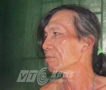 Phước “tám ngón”