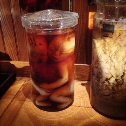 Những thai nhi chết vì bệnh tật, do sơ xuất hoặc do thuốc. Nhìn cảnh này người xem vẫn cảm nhận thấy được khuôn mặt đau đớn của chúng. 