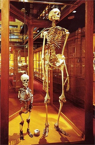 Đột biến về chiều cao. 