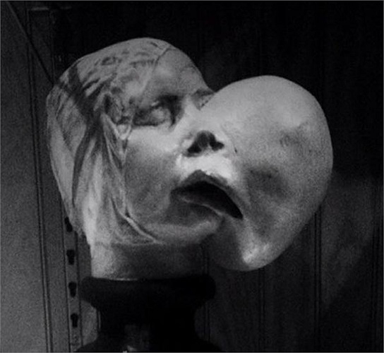 Khuôn mặt bị biến dạng bởi một khối u, khiến người khác liên tưởng đến một chiếc đầu khác đang cố mọc chồi ra. 