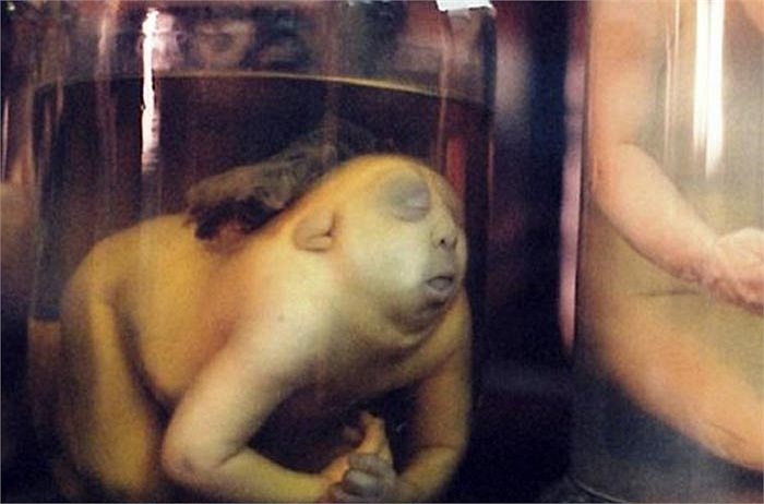 Một trường hợp đột biến cơ thể vô cùng rùng rợn, dường như không thấy mắt và lỗ tai. 