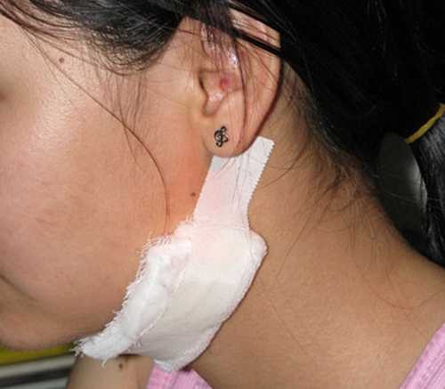 Nữ sinh rạch mặt gây xôn xao dư luận