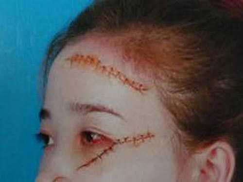 Nữ sinh rạch mặt gây xôn xao dư luận