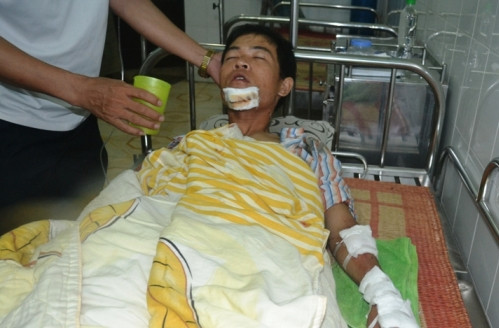 thiếu úy, công an, quăng lưới, quái xế, bất tỉnh