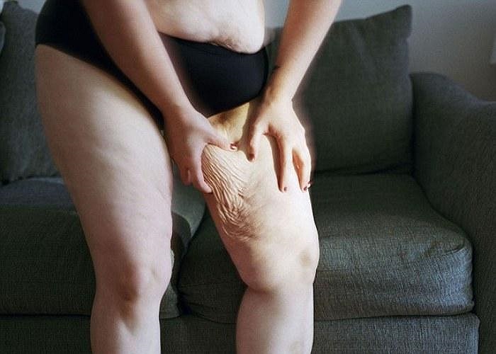 Trong một lần phỏng vấn báo chí, chị Davis cho biết, chị rất ngạc nhiên với những hiệu quả từ việc tự mình chụp ảnh. 