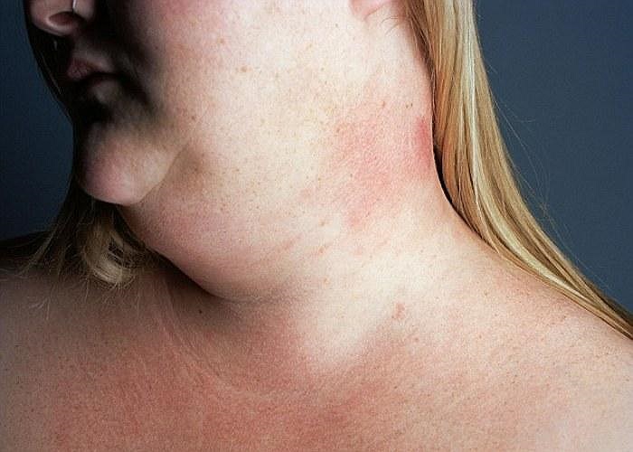 Với chị, những bức ảnh cận cảnh cơ thể do chính mình chụp đã giúp chị vượt qua sự tự ti của bản thân.