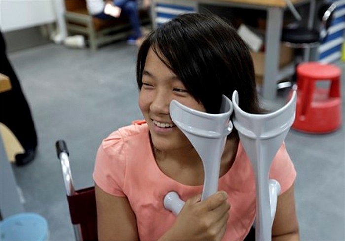 Nhìn thoáng qua, Qian Hongyan, 18 tuổi, sống tại tỉnh Vân Nam - Trung Quốc, trông như những cô gái bình thường khác. Nhưng câu chuyện của em là một ví dụ điển hình cho nghị lực sống phi thường.