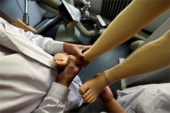 Hình ảnh các bác sĩ đang kiểm tra 2 bàn chân giả cho nữ sinh này.