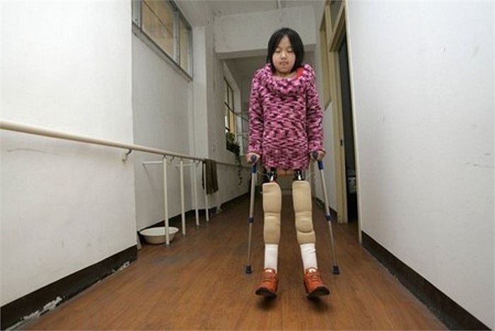 Cô gái nhỏ nhắn này được sinh ra trong một gia đình nghèo khó, giấc mơ đến trường của em đã chấm dứt năm em 11 tuổi. 