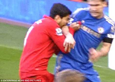 Suarez còn có 'khả năng' cắn người.