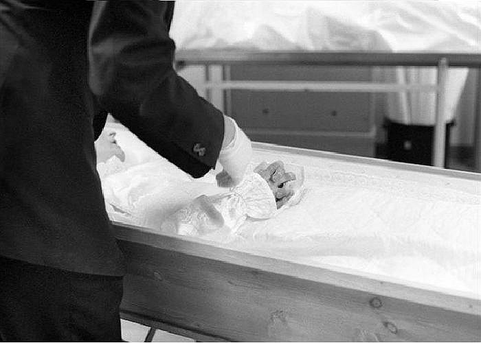 Thân thể người đàn ông này chuẩn bị đem vào kiểm tra.